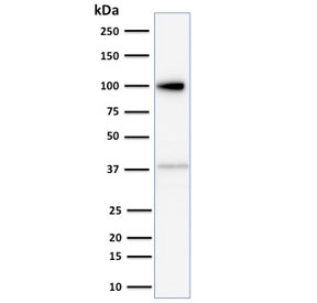Western blot testing of HeLa cell lysate with Major Vault Protein antibody (clone 1014). Observed molec