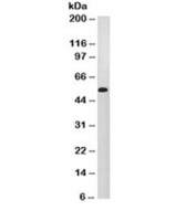 Western blot testing of A431 cell lysate and Cytokeratin 10/13 antibody (clone DE-K13).