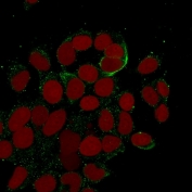 Immunofluorescent staining of MeOH-fixed human MCF7 cells with Cytokeratin 10/13 antibody (clone DE-K13, green) and Reddot nuclear stain (red).