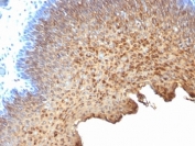 IHC analysis of formalin-fixed, paraffin-embedded human tonsil stained with Cytokeratin 10/13 antibody (clone SPM262).