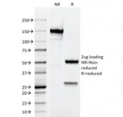SDS-PAGE Analysis of Purified, BSA-Free Testosterone Antibody (clone 4E1G2). Confirmation of Integrity and Purity of the Antibody.