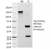 SDS-PAGE Analysis of Purified, BSA-Free Blood Group Lewis a Antibody (clone 7LE). Confirmation of Integrity and Purity of the Antibody.