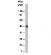 Western blot testing of HeLa cell lysate and Cytokeratin 5/8 antibody (clone C-50). Predicted molecular weight: 52-58kDa but observed here at ~43kDa.