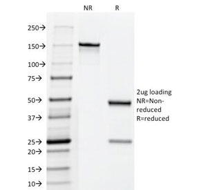 SDS-PAGE Analysis of Purified, BSA-Free hCG Holo Antibody (clone HCGab/52). Confirmation of Integrity and Purity of the Antibody.