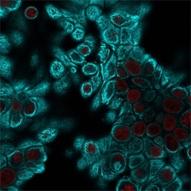 Immunofluorescent staining of human HeLa cells with pan Cytokeratin antibody cocktail (clone Cocktail PAN-CK, cyan) and NucSpot nuclear stain (red).~