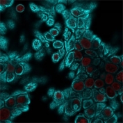 Immunofluorescent staining of human HeLa cells with pan Cytokeratin antibody cocktail (clone Cocktail PAN-CK, cyan) and NucSpot nuclear stain (red).