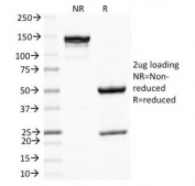 SDS-PAGE Analysis of Purified, BSA-Free Melanoma Antibody (clone PNL2). Confirmation of Integrity and Purity of the Antibody.