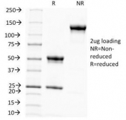 SDS-PAGE Analysis of Purified, BSA-Free Melanoma Associated Antigen Antibody (clone KBA.62). Confirmation of Integrity and Purity of the Antibody.