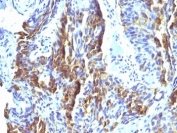 IHC: Formalin-fixed, paraffin-embedded human tongue stained with Melanoma Associated Antigen antibody (clone KBA.62).