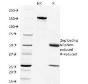 SDS-PAGE Analysis of Purified, BSA-Free Rabies Virus Antibody (clone Rab-50). Confirmation of Integrity and Purity of the Antibody.