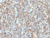 IHC staining of FFPE human tonsil with dsDNA antibody (clone 121-3). HIER: boil tissue sections in pH 9 10mM Tris with 1mM EDTA for 10-20 min and allow to cool before testing.