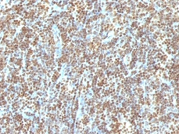 IHC staining of FFPE human tonsil with dsDNA antibo
