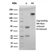 SDS-PAGE analysis of purified, BSA-free dsDNA antibody (clone 121-3) as confirmation of integrity and purity.