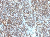 IHC: Formalin-fixed, paraffin-embedded human tonsil stained with Double Stranded DNA antibody (SPM603).