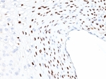 IHC: Formalin-fixed, paraffin-embedded human cervix stained with HPV-16 L1 antibody (clone HPV16L1/1058).
