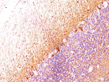 IHC: Formalin-fixed, paraffin-embedded human cerebellum stained with Neurofilament antibody (RT-97 + NR-4).~