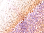 IHC: Formalin-fixed, paraffin-embedded human cerebellum stained with Neurofilament antibody (RT-97 + NR-4).