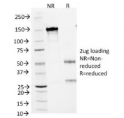 SDS-PAGE Analysis of Purified, BSA-Free SCLC Marker Antibody (clone MOC-52). Confirmation of Integrity and Purity of the Antibody.