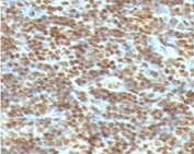 IHC staining of FFPE human tonsil with dsDNA antibody (clone AE-2). HIER: boil tissue sections in pH 9 10mM Tris with 1mM EDTA for 10-20 min and allow to cool before testing.