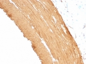 IHC: Formalin-fixed, paraffin-embedded rat stomach stained with pan Muscle Actin antibody (clone MSA/953).