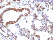 IHC: Formalin-fixed, paraffin-embedded rat lung stained with pan Muscle Actin antibody (clone MSA/953).