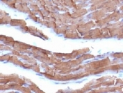 IHC: Formalin-fixed, paraffin-embedded rat heart stained with pan Muscle Actin antibody (clone MSA/953).