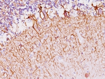 IHC: Formalin-fixed, paraffin-embedded human cerebellum stained with Neurofilament antibody (SPM145).