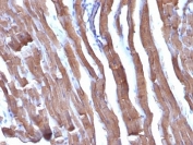 IHC: Formalin-fixed, paraffin-embedded rat heart stained with pan Muscle Actin antibody