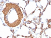 IHC: Formalin-fixed, paraffin-embedded rat lung stained with pan Muscle Actin antibody