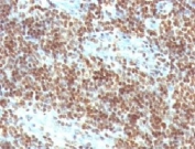 IHC: Formalin-fixed, paraffin-embedded human tonsil stained with Double Stranded DNA antibody (clone DSD/958).