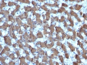 IHC: Formalin-fixed, paraffin-embedded human liver stained with HepPar1 antibody (clone HepPar1).