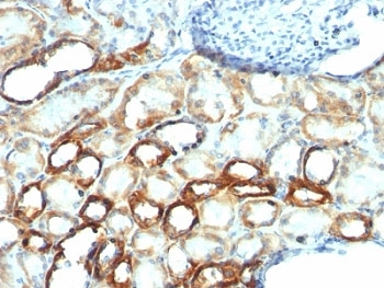 IHC: Formalin-fixed, paraffin-embedded human tonsil stained with anti-Mitochondrial antibody (AE-1).
