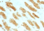 IHC: Formalin paraffin rat stomach stained with Basic Cytokeratin antibody (KRTH/1076).