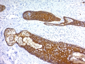 IHC: Formalin paraffin human skin stained with Basic Cytokeratin antibody (KRTH/1076).~