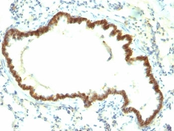 IHC: Formalin-fixed, paraffin-embedded rat lung stained with EpCAM antibody (Epcam/1159).~