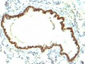 IHC: Formalin-fixed, paraffin-embedded rat lung stained with EpCAM antibody (Epcam/1159).