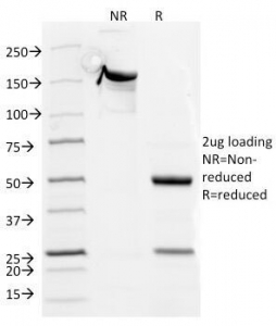 SDS-PAGE Analysis of Purified, BSA-Free CD5 Antibody (clone CD5/54/F6). Confirmation of Integrity and Purity of the Antibody.