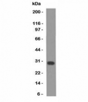 Western blot analysis of Jurkat cell lysate using Bcl-X antibody (BX006 + 2H12).
