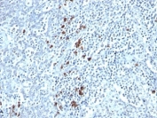 IHC: Formalin-fixed, paraffin-embedded human tonsil stained with Kappa Light Chain antibody (clone TB28-2).