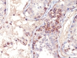 IHC analysis of formalin-fixed, paraffin-embedded human testis stained with MAGE-1 antibody (clone MA454).