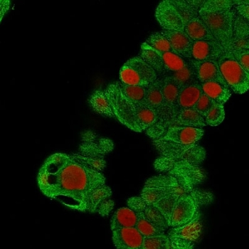Immunofluorescent staining of MeOH fixed human MCF7 cells with Keratin 19 antibody (clone BA17, green) and Reddot nuclear stain (red).~