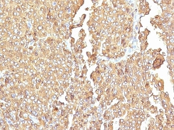 IHC: Formalin-fixed, paraffin-embedded human adrenal gland stained with Chromogranin A antibody (LK2H10 + PHE5)~