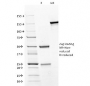 SDS-PAGE analysis of purified, BSA-free CD31 antibody (clone JC/70A) as confirmation of integrity and purity.