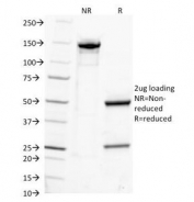 SDS-PAGE Analysis of Purified, BSA-Free IgG Antibody (clone IG217). Confirmation of Integrity and Purity of the Antibody.