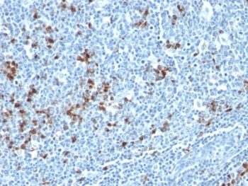 IHC: Formalin-fixed, paraffin-embedded human tonsil stained with Kappa Light Chain antibody (HP6053 + L1C1).~