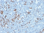 IHC: Formalin-fixed, paraffin-embedded human tonsil stained with Kappa Light Chain antibody (HP6053 + L1C1).
