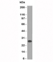 Western blot of human Intestinal lysate using Lambda Light Chain antibody (HP6054).