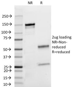 SDS-PAGE Analysis of Purified, BSA-Free Lambda Light Chain Antibody (clone HP6054). Confirmation of Integrity and Purity of the Antib