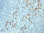 IHC: Formalin-fixed, paraffin-embedded human tonsil stained with Lambda Light Chain antibody (HP6054).