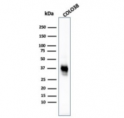 Western blot testing of human COLO-38 cell lysate with Melanoma Cell Marker antibody cocktail (clones M2-7C10 + M2-9E3 + HMB45 + T311).